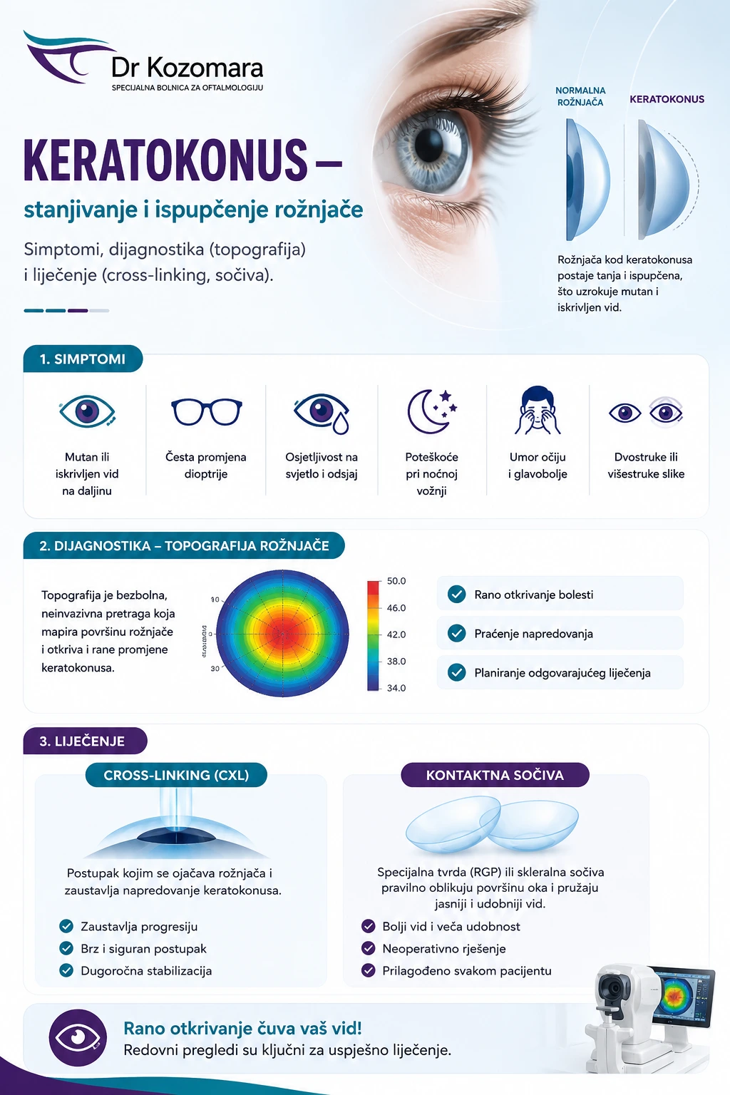 Infografika o keratokonusu &ndash; simptomi, topografija rožnjače, cross-linking i kontaktna sočiva