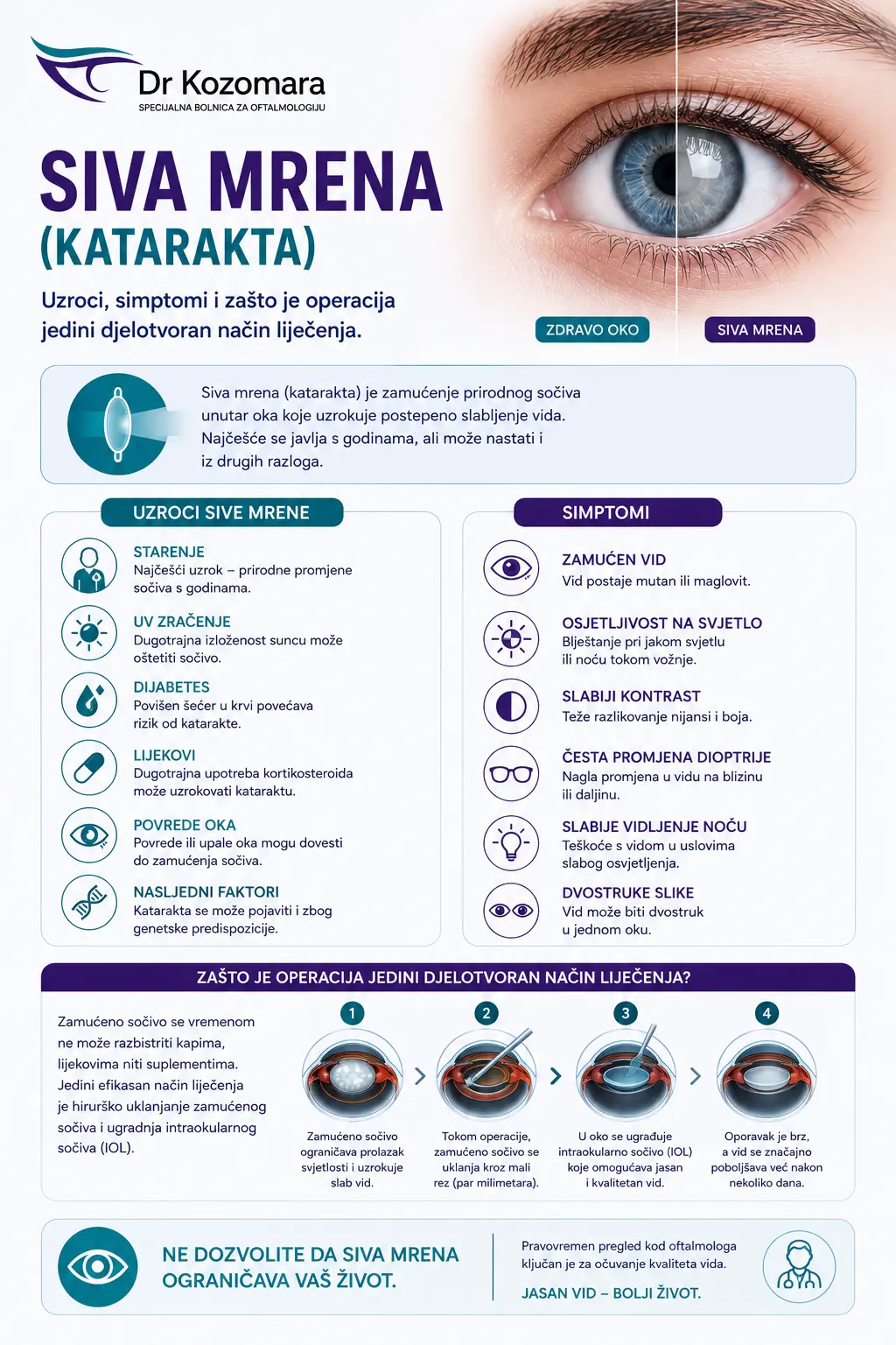 Infografika o sivoj mreni ili katarakti &ndash; uzroci, simptomi i operacija kao djelotvoran način liječenja