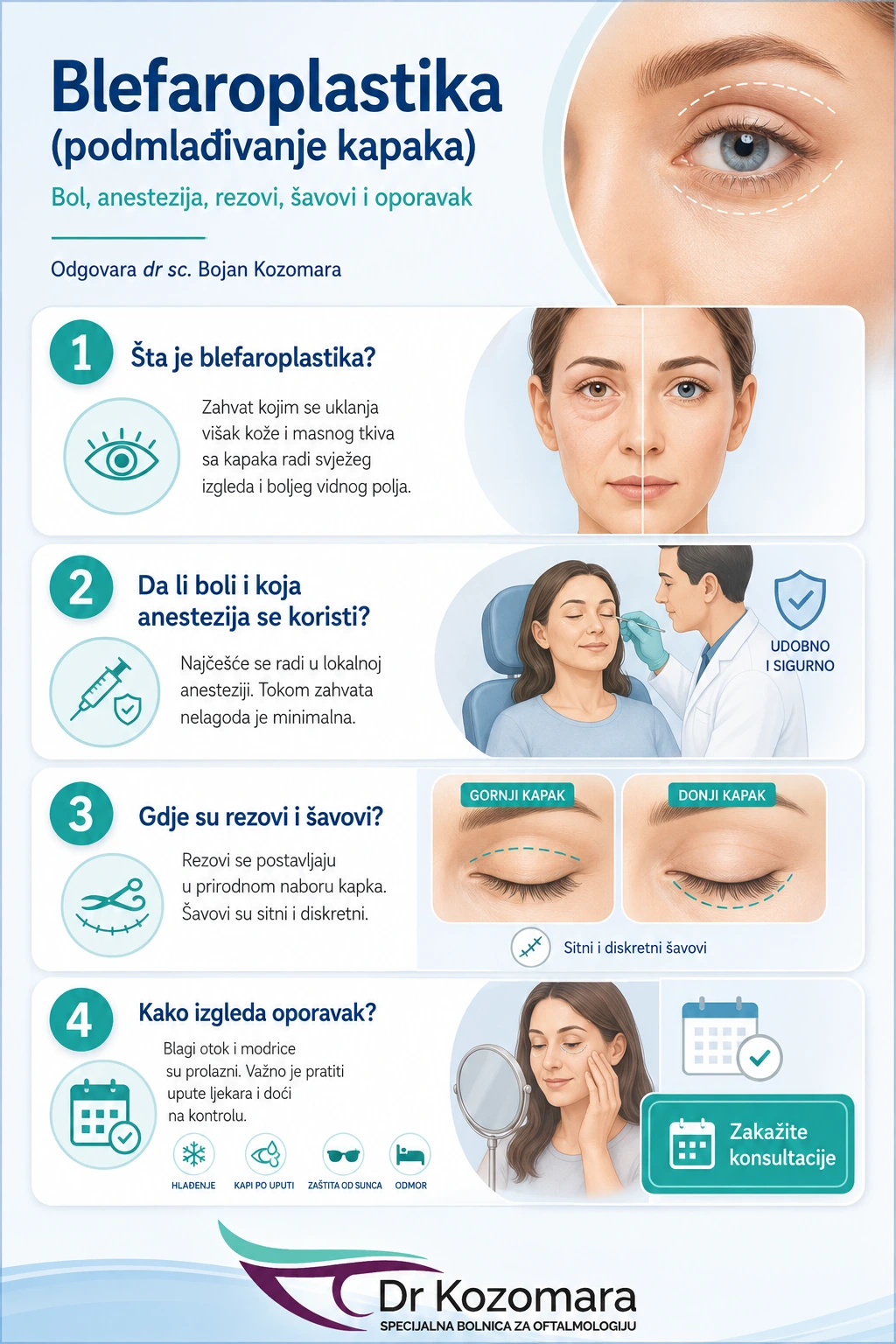 Blefaroplastika – sve o zahvatu, oporavku i konsultacijama Infografika o blefaroplastici sa objašnjenjem zahvata, anestezije, rezova, šavova i oporavka