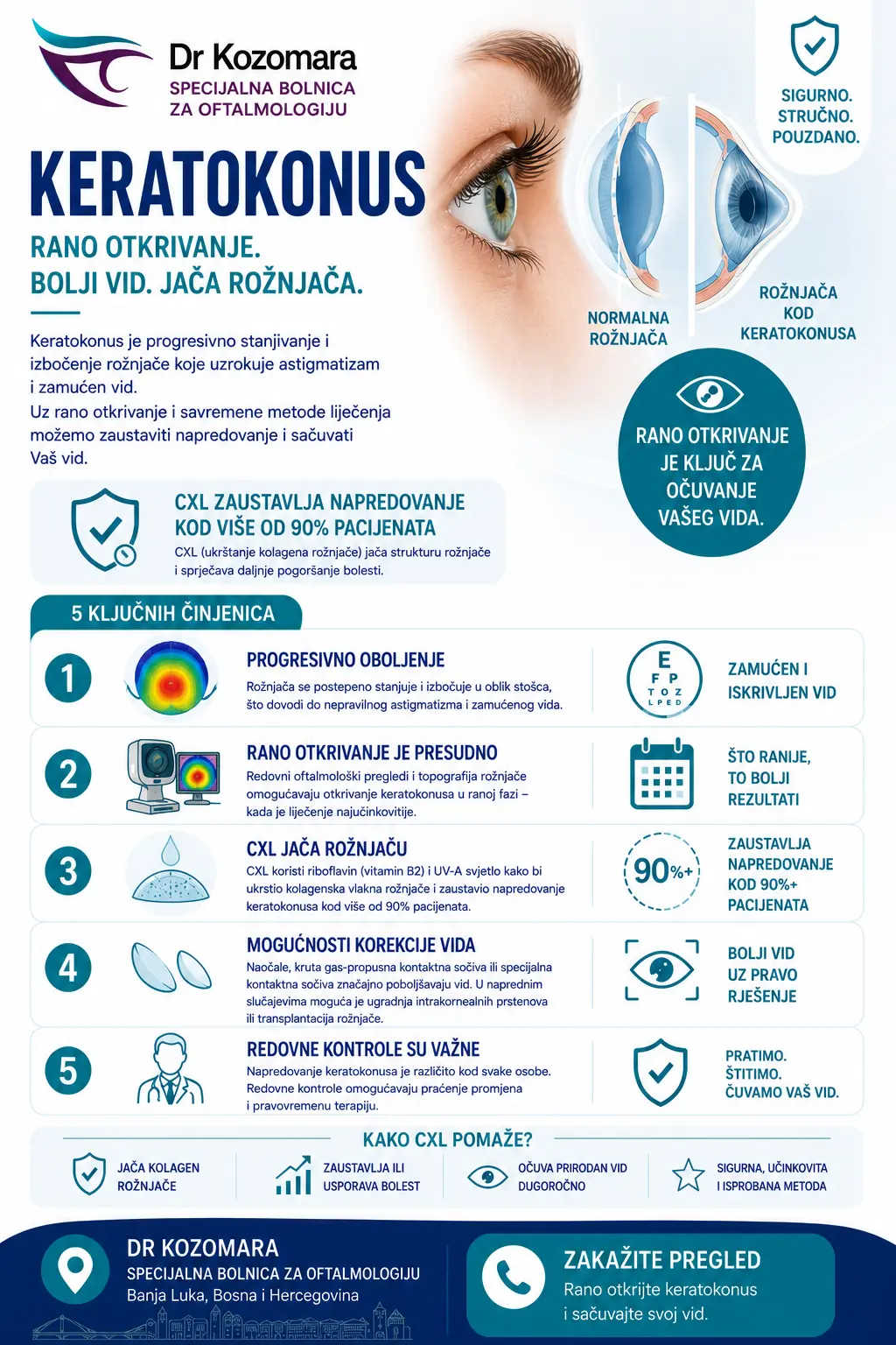 Keratokonus – rano otkrivanje i CXL liječenje Keratokonus – rano otkrivanje i CXL liječenje koje zaustavlja napredovanje kod više od 90% pacijenata