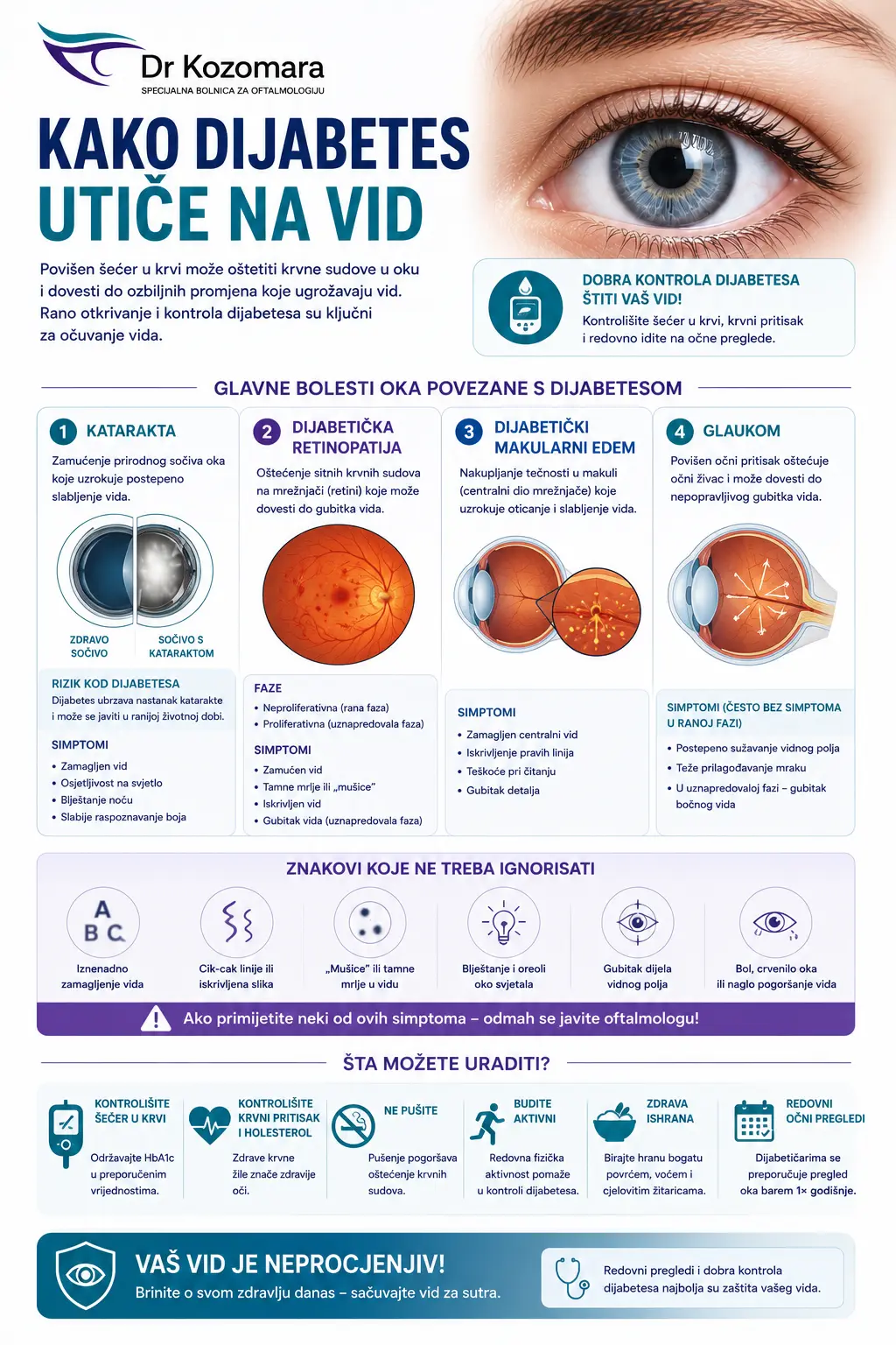 Infografika o uticaju dijabetesa na vid &ndash; katarakta, dijabetička retinopatija, makularni edem i glaukom