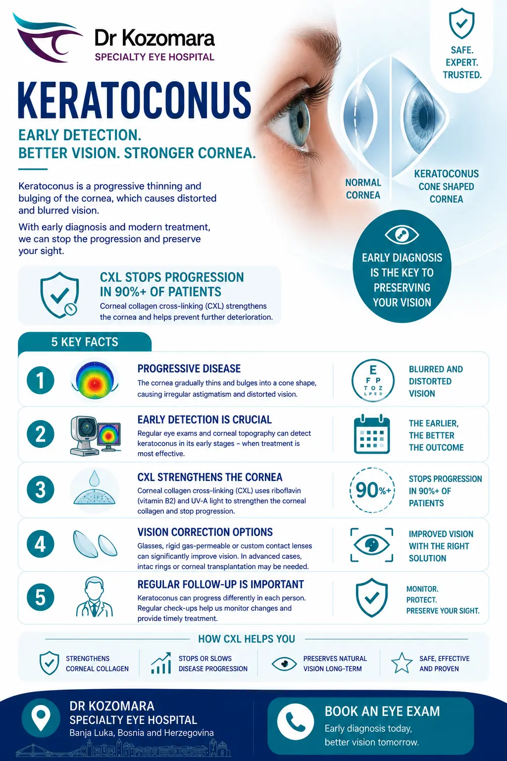 Keratoconus &ndash; early detection and CXL treatment that stops progression in more than 90% of patients