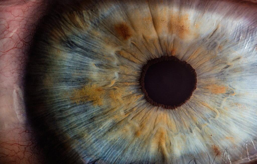 Odličan vid ne znači i zdravo oko