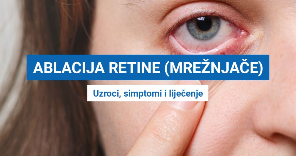 Ablacija ili odvajanje retine (mrežnjače) oka (UZROCI, SIMPTOMI I LIJEČENJE)