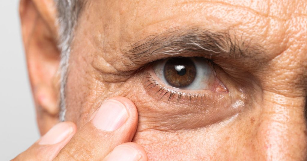 Visok nivo žive povezan sa nastankom glaukoma