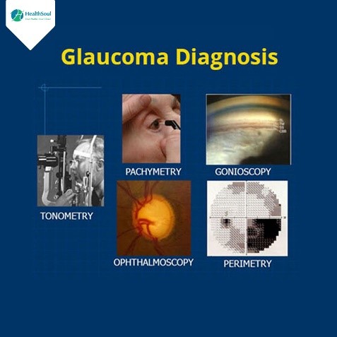 dijagnoza glaukoma