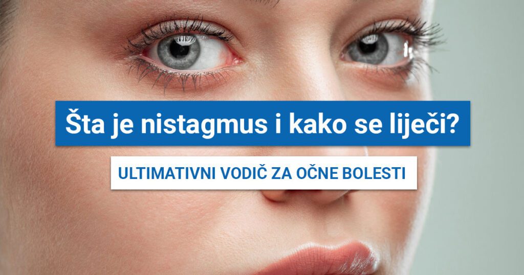 Nistagmus (SIMPTOMI, UZROCI, LIJEČENJE, VJEŽBE I VRSTE)