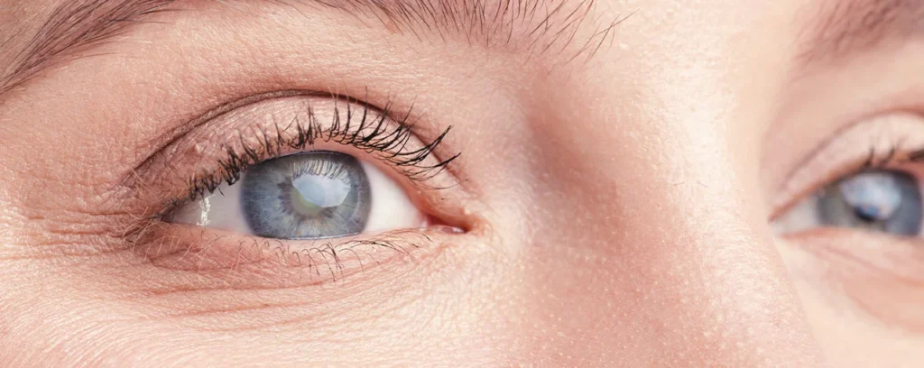 Svjetska sedmica glaukoma: Zašto glaukom zovemo tihi kradljivac vida?