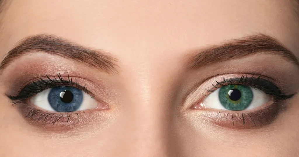 Heterohromija: kada boja oka nije jednaka
