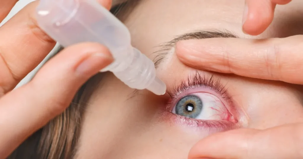 Možete li prepoznati simptome konjunktivitisa (crvenog oka) kada ih vidite?
